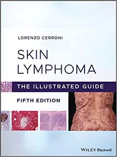 9781119485902 Skin Lymphoma: The Illustrated Guide