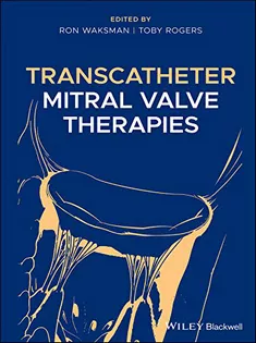 9781119490685 Transcatheter Mitral Valve Therapies