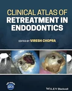 Clinical Atlas of Retreatment in Endodontics
