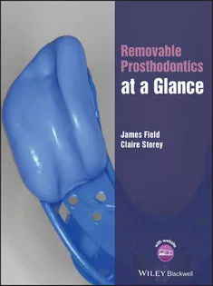Removable Prosthodontics at A Glance