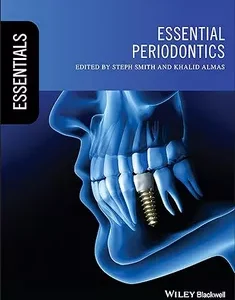Essential Periodontics