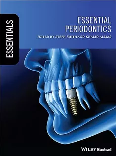 Essential Periodontics