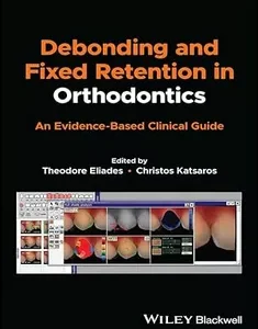 Debonding and Fixed Retention in Orthodontics: An Evidence-Based Clinical Guide