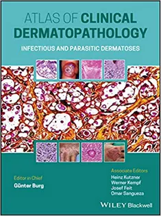 Atlas Clinical of Dermatopathology: Infectious and Parasitic Dermatoses