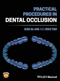 Practical Procedures in Dental Occlusion