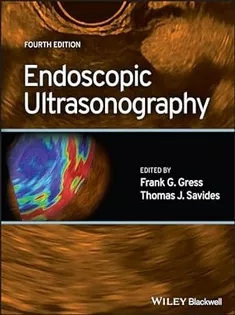Endoscopic Ultrasonography