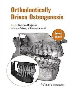 Orthodontically Driven Osteogenesis
