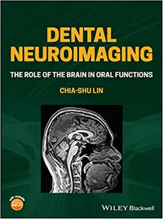Dental Neuroimaging: The Role of the Brain in Oral Functions