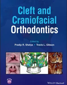 Cleft and Craniofacial Orthodontics