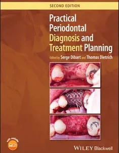 Practical Periodontal Diagnosis and Treatment Planning