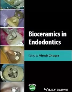 Bioceramics in Endodontics