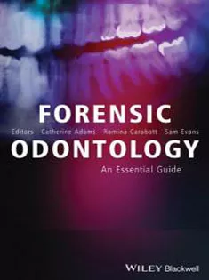 Forensic Odontology