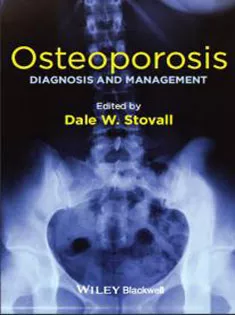 Osteoporosis