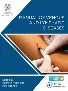 Manual of Venous and Lymphatic Diseases