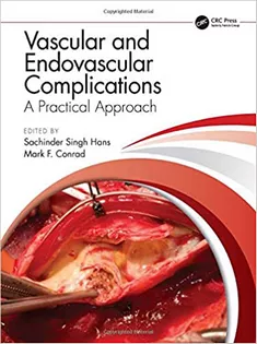 Vascular and Endovascular Complications