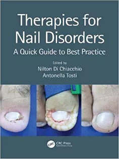 Therapies for Nail Disorders: A Quick Guide to Best Practice