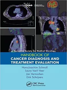 Esmo Handbook of Cancer Diagnosis and Treatment Evaluation