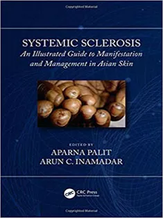 Systemic Sclerosis: An Illustrated Guide to Manifestation and Management in Asian Skin