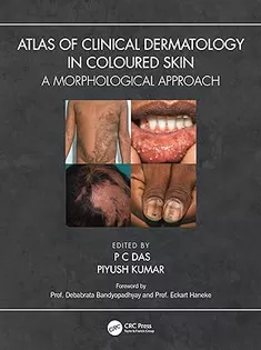 Atlas of Clinical Dermatology in Coloured Skin: A Morphological Approach