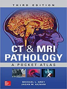 CT & MRI Pathology: A Pocket Atlas