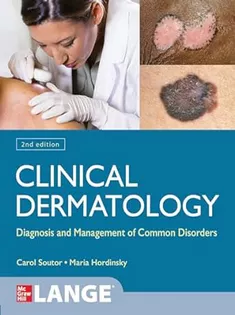 Clinical Dermatology: Diagnosis and Management of Common Disorders
