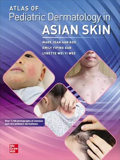 Atlas of Pediatric Dermatology in Asian Skin
