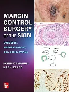 Margin Control Surgery of the Skin