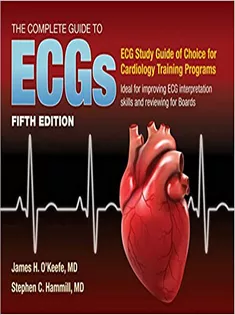 The Complete Guide to ECGs