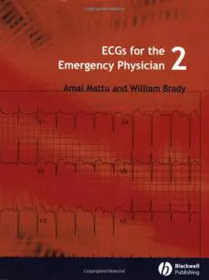 ECGs For The Emergency Physician 2