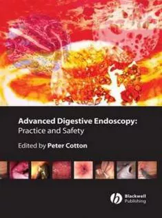 Advanced Digestive Endoscopy: Practice and Safety