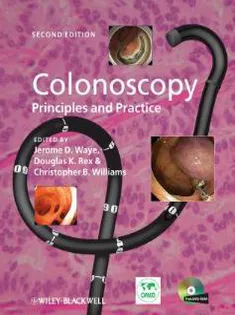 Colonoscopy: Principles & Practice