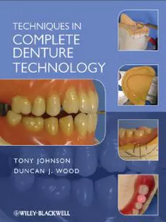 Techniques in Complete Denture Technology