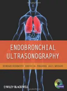 Endobronchial Ultrasonography2011