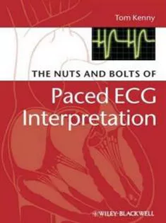 The Nuts and Bolts of Paced ECG Interpretation