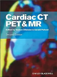 Cardiac CT, PET and MR