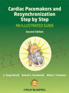 Cardiac Pacemakers and Resynchronization Step by Step