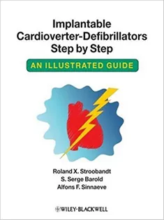 Implantable Cardioverter-defibrillators Step by Step