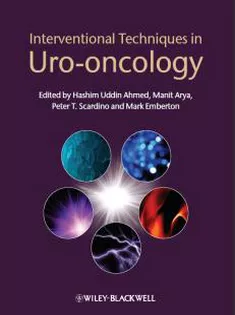 Interventional Techniques In Uro-Oncology