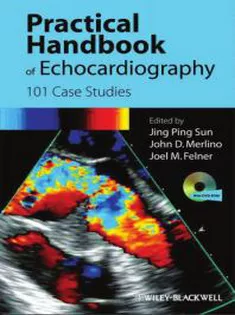 Practical Handbook of Echocardiography: 101 Case Studies