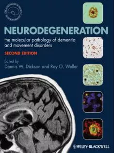 Neurodegeneration: The Molecular Pathology of Dementia and Movement Disorders
