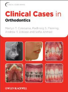 Clinical Cases In Orthdontics