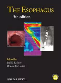 The Esophagus1