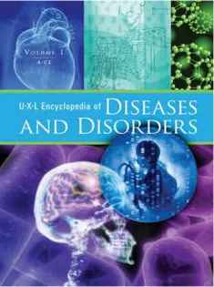 UXL Encyclopedia of Diseases and Disorders
