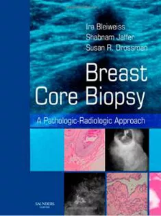 Breast Core Biopsy A Pathologic - Radiologic Approach