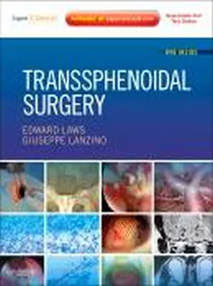 Transsphenoidal Surgery