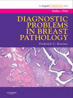 Diagnostic Problems In Breast Pathology