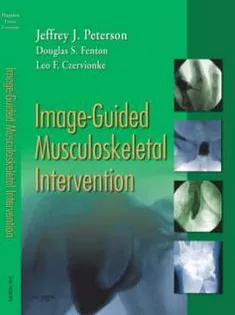 Image-Guided Musculoskeletal Intervention