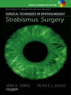 Surgical Techniques in Ophthalmology Series: Strabismus Surgery