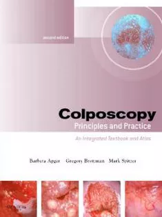 Colposcopy Principles And Practice