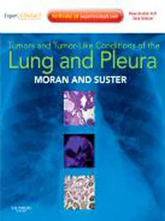 Tumors and Tumor-like Conditions of the Lung and Pleura